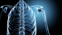 //rjrorwxhpqpqlj5m.ldycdn.com/cloud/lobppkqplnsrjllljqmkjjp/medical-titanium.jpg