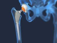 //rjrorwxhpqpqlj5m.ldycdn.com/cloud/prBppKqplnSRqlojorqijm/Medical-Titanium.jpg
